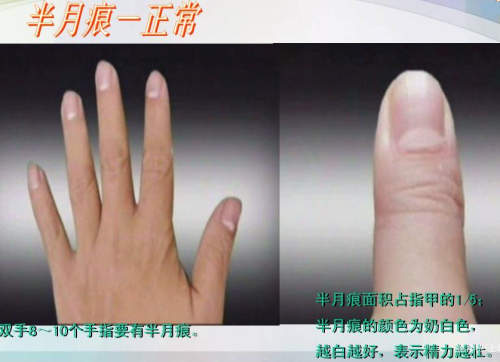 指甲看健康